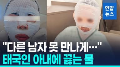 [영상] "다른 남자 만날까 봐"…태국인 아내 얼굴에 끓는 물 부은 남성