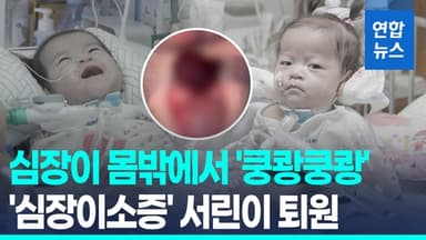 [영상] '쿵쾅쿵쾅' 몸밖에서 뛰던 심장…두달간 고난도 수술로 제자리