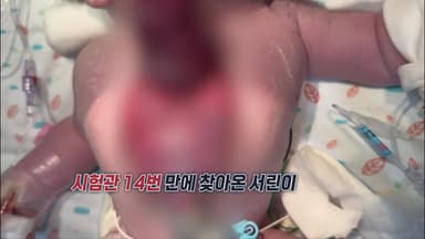 몸 바깥에서 심장 뛰던 '서린이', 국내 첫 수술 성공..."절망 속 희망 준 의료진께 감사" [앵커리포트]