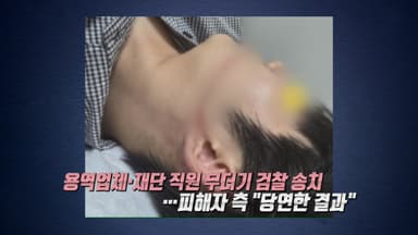 물축제 워터건에 피부 50cm 찢어져...용역업체·재단 직원 검찰 송치 [앵커리포트]