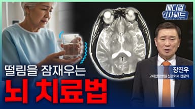 [메디컬 인사이트 120회] 떨림을 잠재우는 '뇌치료법'