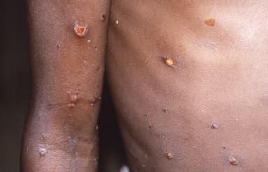 200명 넘게 사망한 무서운 그 바이러스 또···아시아서 '새 변이' 발견됐다